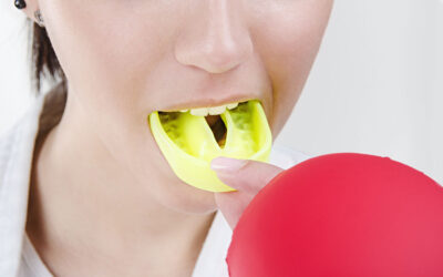 Custom-fitted Mouthguards – Protect your smile